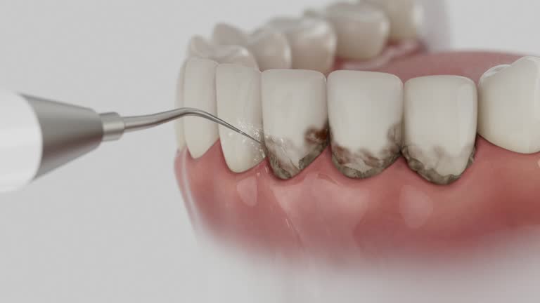 Trusted Invisalign Clear Aligners service in Beach, ND - Dentist Open Now